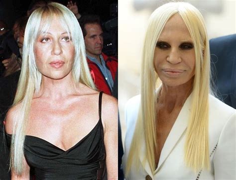 donatella versace assassination|donatella versace plastic surgery 2022.